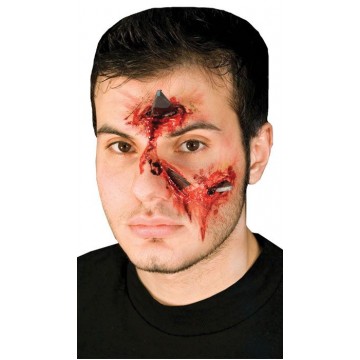 Woochie Metal Attack - Injuiry