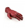 Burnt Hand